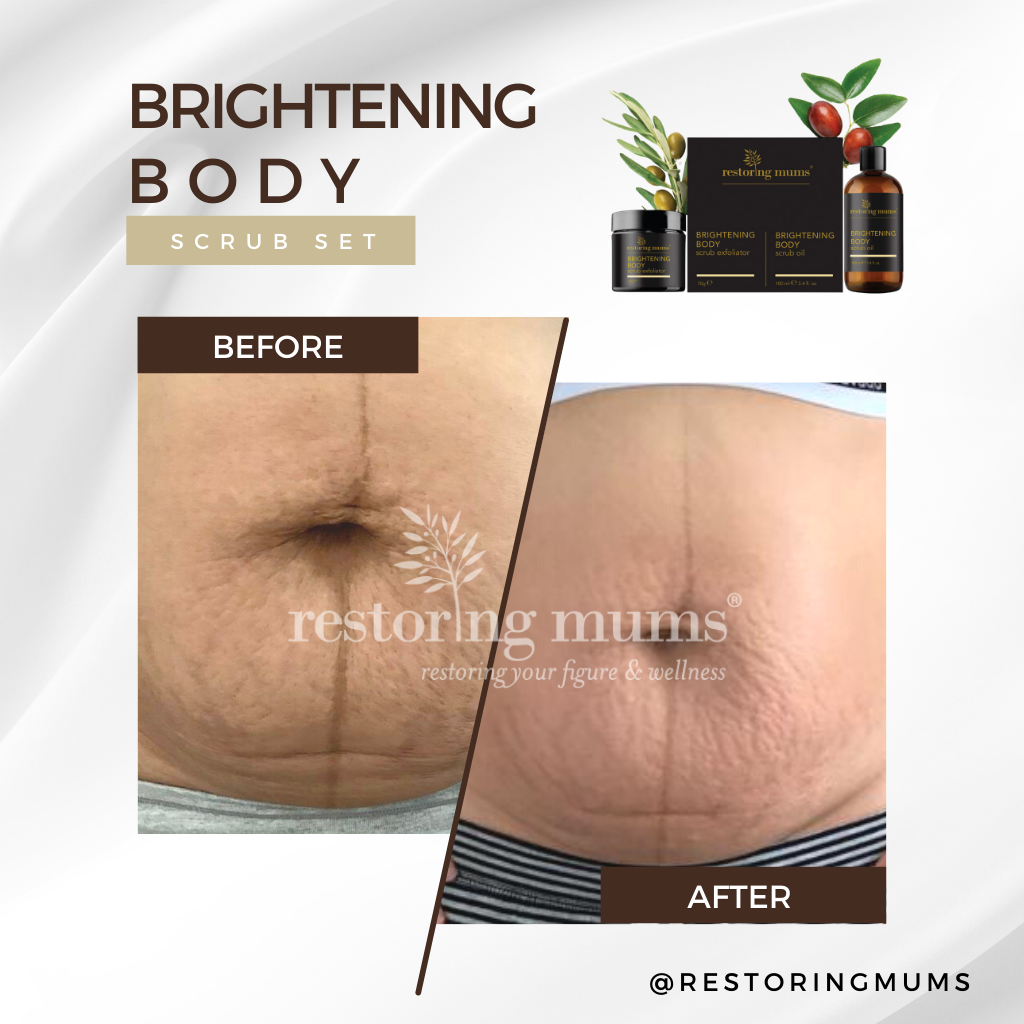 Wrinkly Tummy Skin Solution