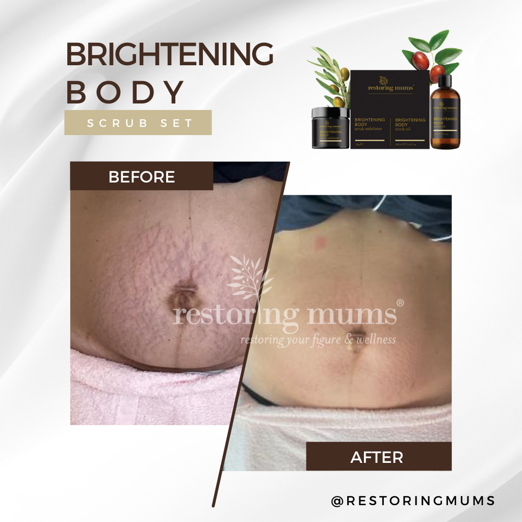 Wrinkly Tummy Skin Solution