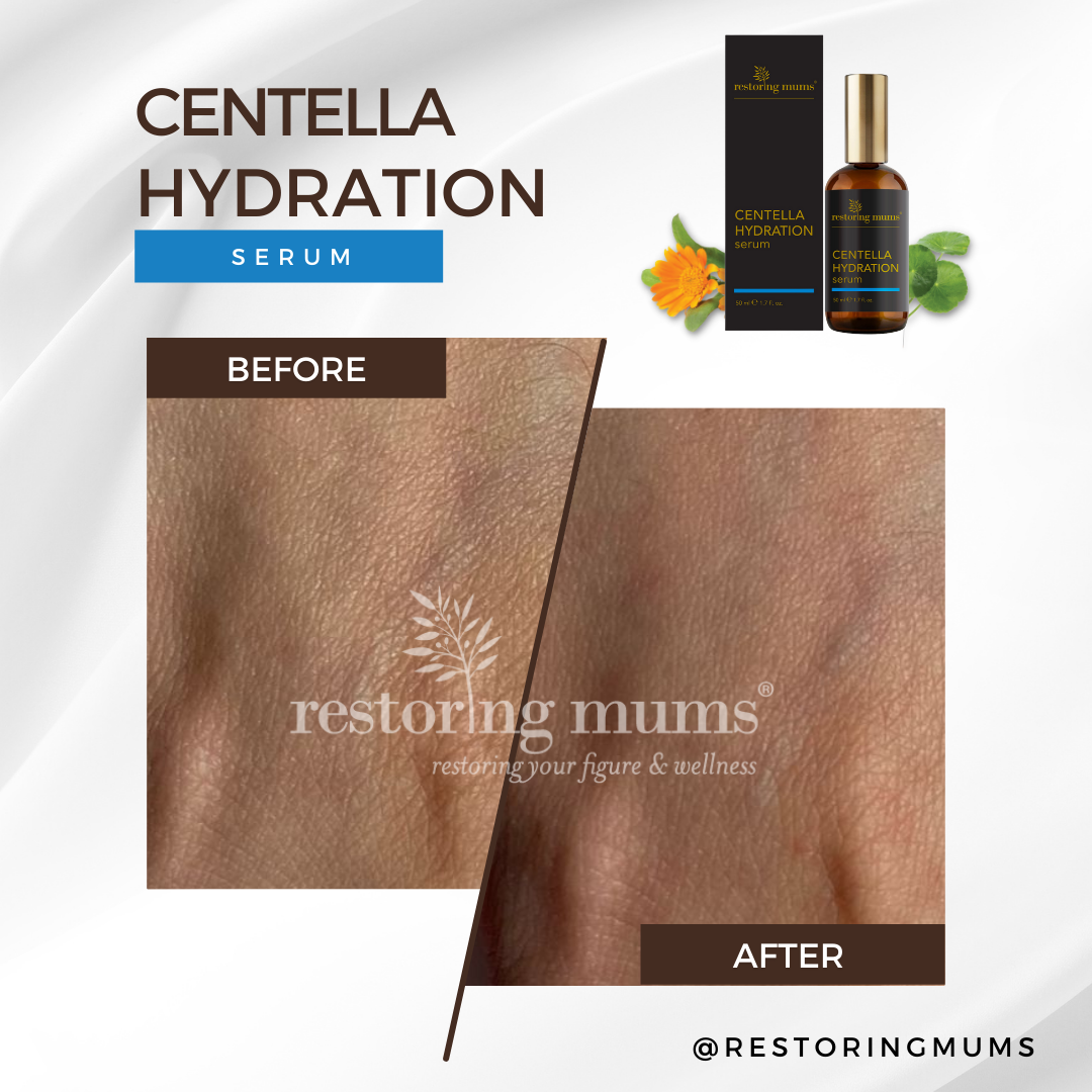 Skin Elasticity Solution